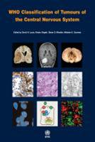 Classification of Tumours: Central Nervous System Classification of Tumours: Central Nervous System