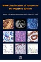 Classification of Tumours: Digestive System Classification of Tumours: Digestive System
